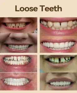 𝐇𝐢𝐝𝐨𝐧𝐞® - 𝐏𝐫𝐞𝐦𝐢𝐮𝐦 𝐃𝐞𝐧𝐭𝐮𝐫𝐞