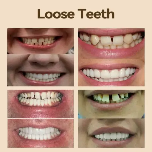 𝐇𝐢𝐝𝐨𝐧𝐞® - 𝐏𝐫𝐞𝐦𝐢𝐮𝐦 𝐃𝐞𝐧𝐭𝐮𝐫𝐞
