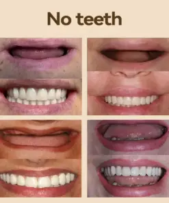 𝐇𝐢𝐝𝐨𝐧𝐞® - 𝐏𝐫𝐞𝐦𝐢𝐮𝐦 𝐃𝐞𝐧𝐭𝐮𝐫𝐞