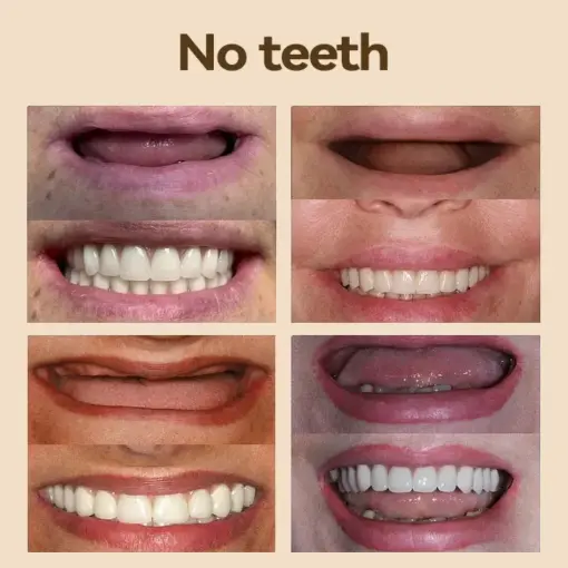 𝐇𝐢𝐝𝐨𝐧𝐞® - 𝐏𝐫𝐞𝐦𝐢𝐮𝐦 𝐃𝐞𝐧𝐭𝐮𝐫𝐞