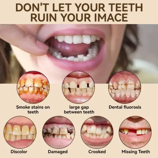 𝐇𝐢𝐝𝐨𝐧𝐞® - 𝐏𝐫𝐞𝐦𝐢𝐮𝐦 𝐃𝐞𝐧𝐭𝐮𝐫𝐞